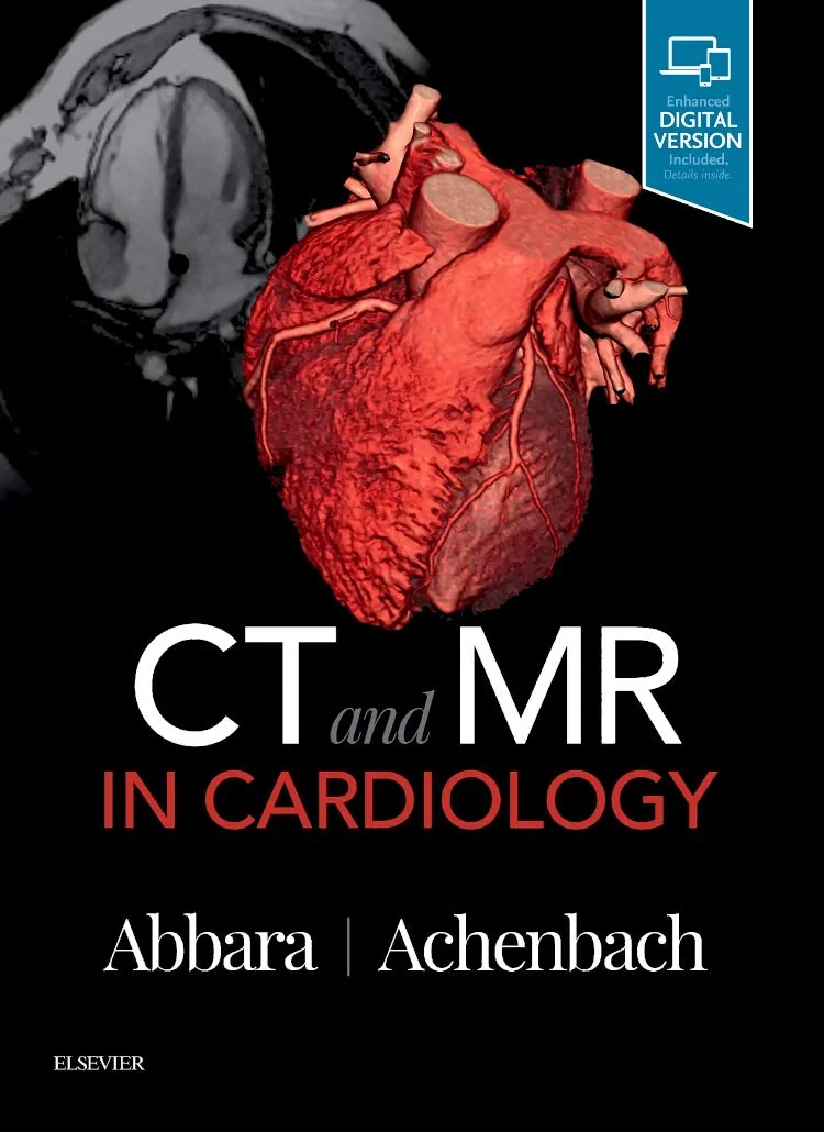Coperta cărții "CT and MR in Cardiology, 1e" de MD, Suhny Abbara, Chief, Cardiothoracic Imaging Division; Professor, Department of Radiology, UT Southwestern Medical Center, Dallas, Texas, USA and Stephan Achenbach, FESC, FACC, Professor of Medicine, Chairman, Department of Cardiology, Erlangen, Germany, Professor, Cardiothoracic Imaging Division, University of Erlangen-Nürnberg