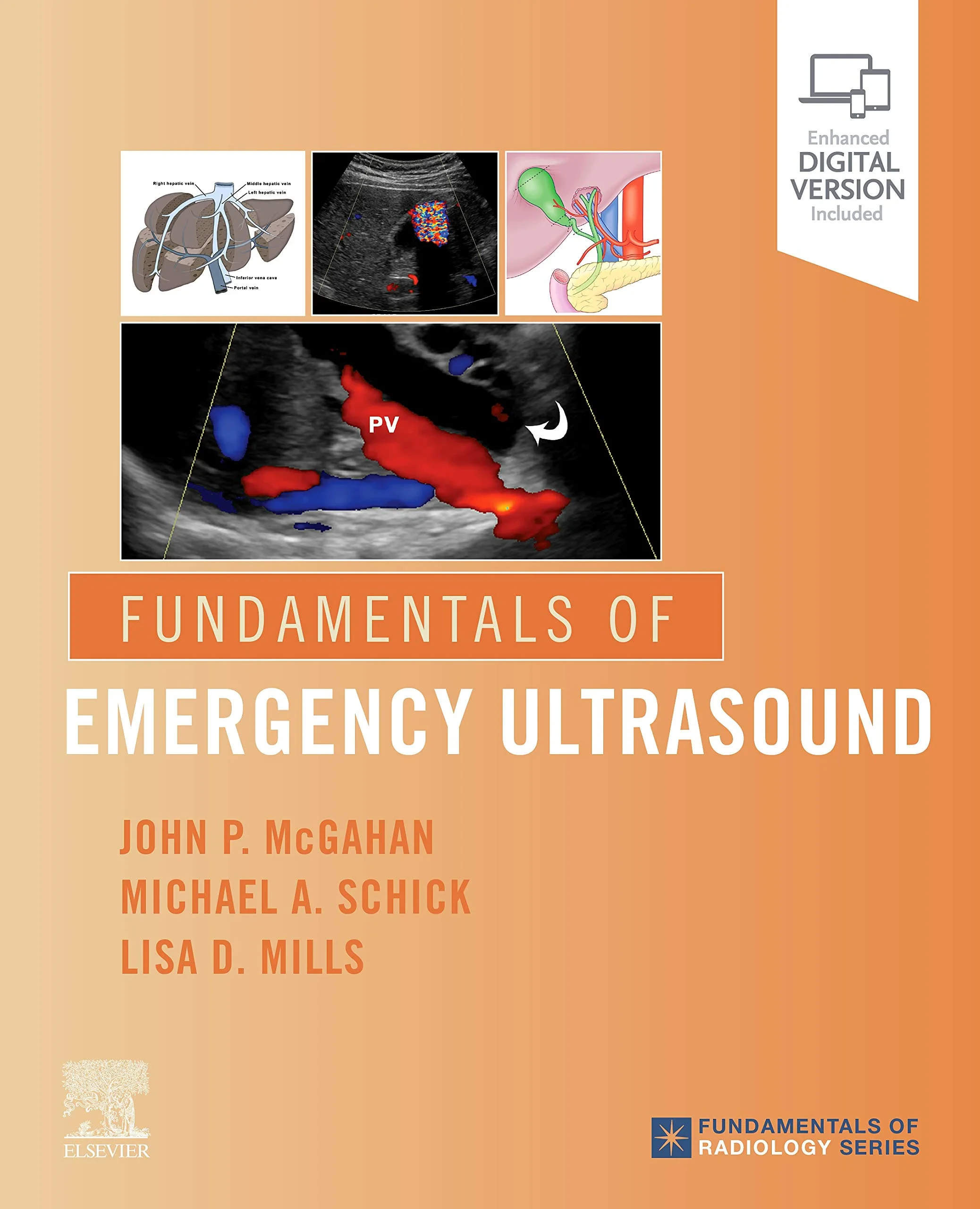 Coperta cărții "Fundamentals of Emergency Ultrasound " de John P. McGahan MD, Michael A Schick DO MD, Lisa Mills MD