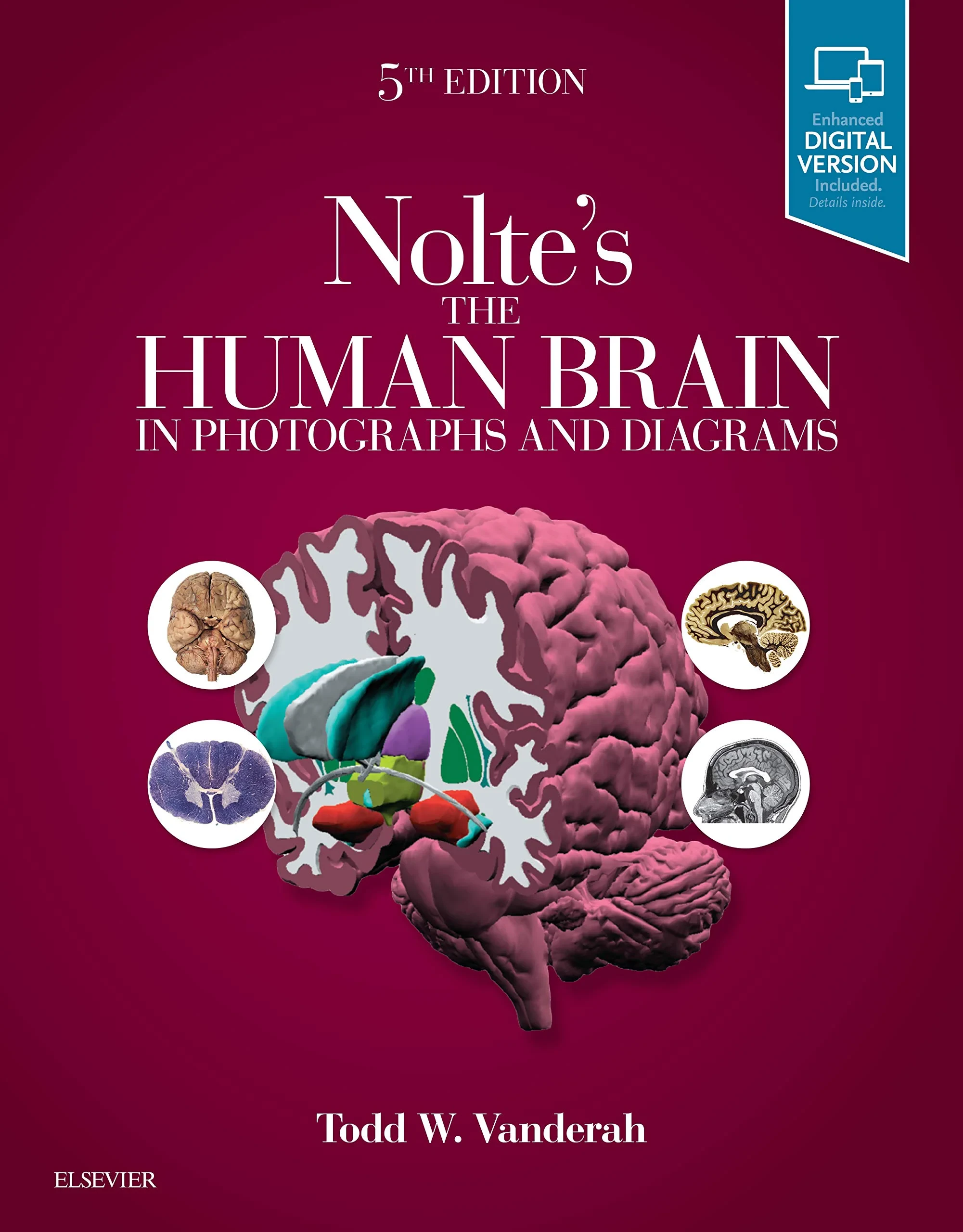 Coperta cărții "Nolte's The Human Brain in Photographs and Diagrams, 5e: With STUDENT CONSULT Online Access" de Todd Vanderah
