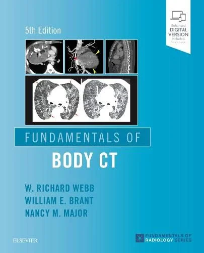 Coperta cărții "Fundamentals of Body CT " de W. Richard Webb, Nancy M. Major, Wiliam E. Brant