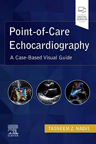 Coperta cărții "Point-of-Care Echocardiography: A Clinical Case-Based Visual Guide " de Tasneem Z. Naqvi MD FRCP (Lon.UK) MMM FASE FACC