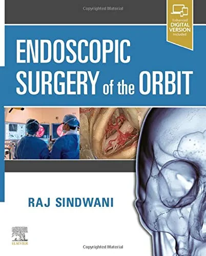 Coperta cărții "Endoscopic Surgery of the Orbit" de Raj Sindwani MD FRCS