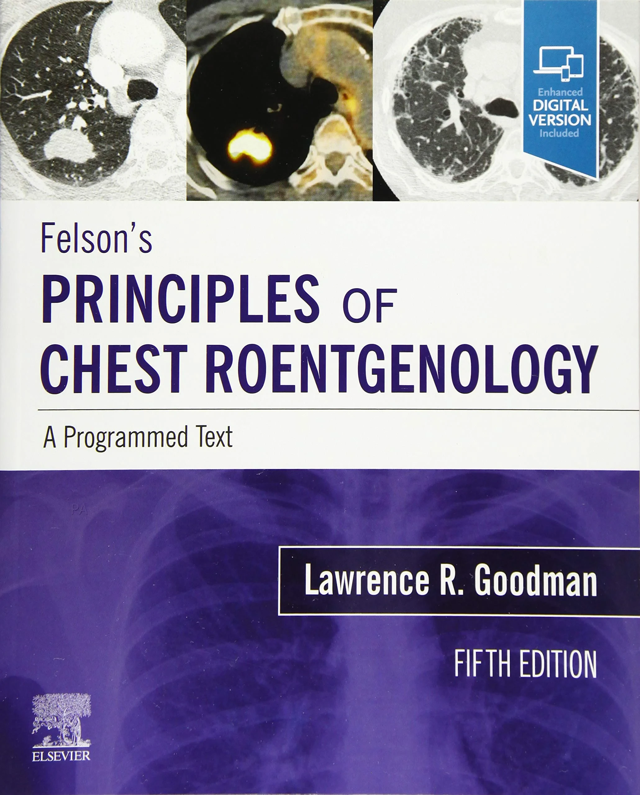 Coperta cărții "Felson's Principles of Chest Roentgenology, A Programmed Text" de Lawrence R. Goodman
