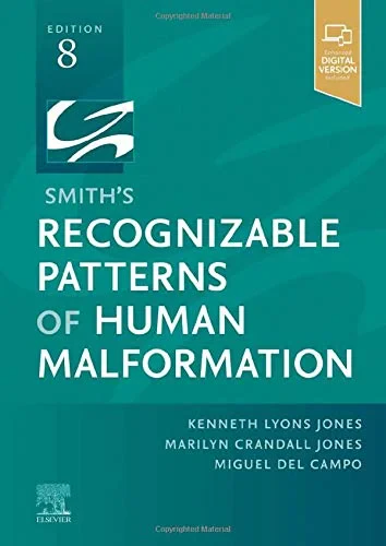 Coperta cărții "Smith's Recognizable Patterns of Human Malformation: Expert Consult - Online and Print" de Kenneth Lyons Jones MD (Author), Marilyn Crandall Jones MD, Miguel del Campo MD PhD