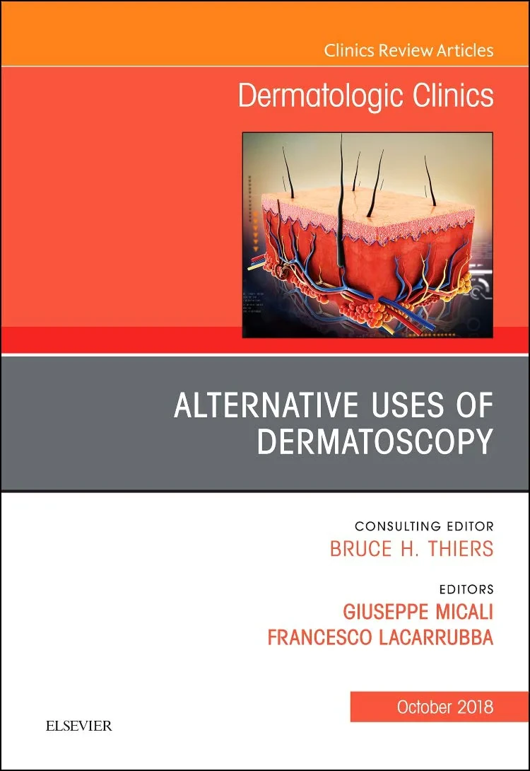 Coperta cărții "Alternative Uses of Dermatoscopy, An Issue of Dermatologic Clinics, Volume 36-4" de Micali &amp; Lacarrubba