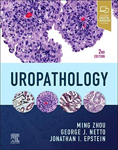 Coperta cărții "Uropathology" de Jonathan I. Epstein, Ming Zhou, George Netto