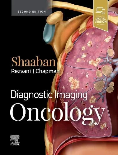 Coperta cărții "Diagnostic Imaging: Oncology, 2nd Edition" de Akram M. Shaaban