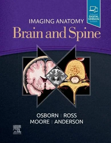 Coperta cărții "Imaging Anatomy Brain and Spine " de Kevin R. Moore MD, Anne G. Osborn MD FACR, Karen L. Salzman MD, Jeffrey S. Anderson MD PhD, Arthur W. Toga, Meng Law MD, Jeffrey Ross MD