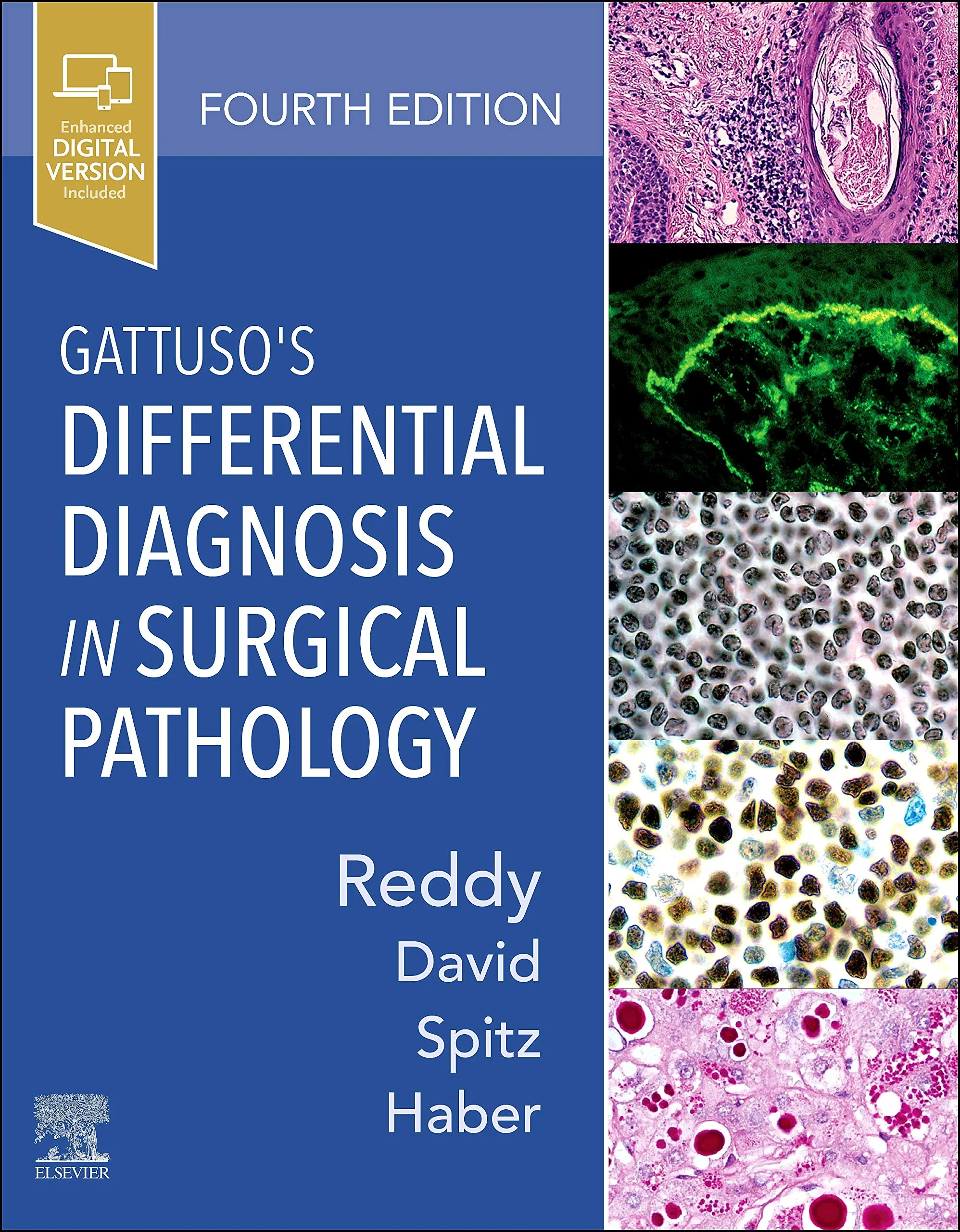 Coperta cărții "Gattuso’s Differential Diagnosis in Surgical Pathology" de Vijaya B. Reddy MD MBA, Odile David MD MPH, Daniel J. Spitz MD, Meryl H. Haber MD