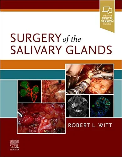 Coperta cărții "Surgery of the Salivary Glands" de Robert L. Witt MD