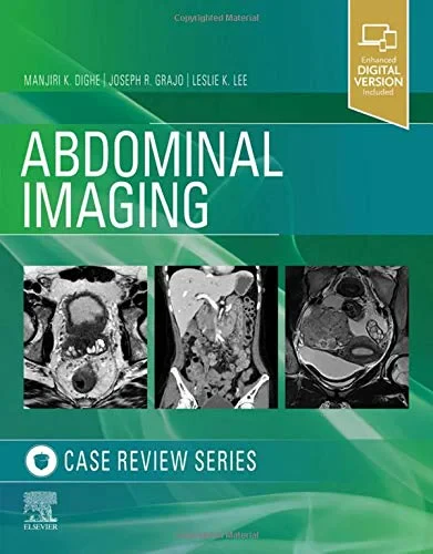 Coperta cărții "Abdominal Imaging" de Joseph R. Grajo, Manjiri Dighe, Leslie Lee