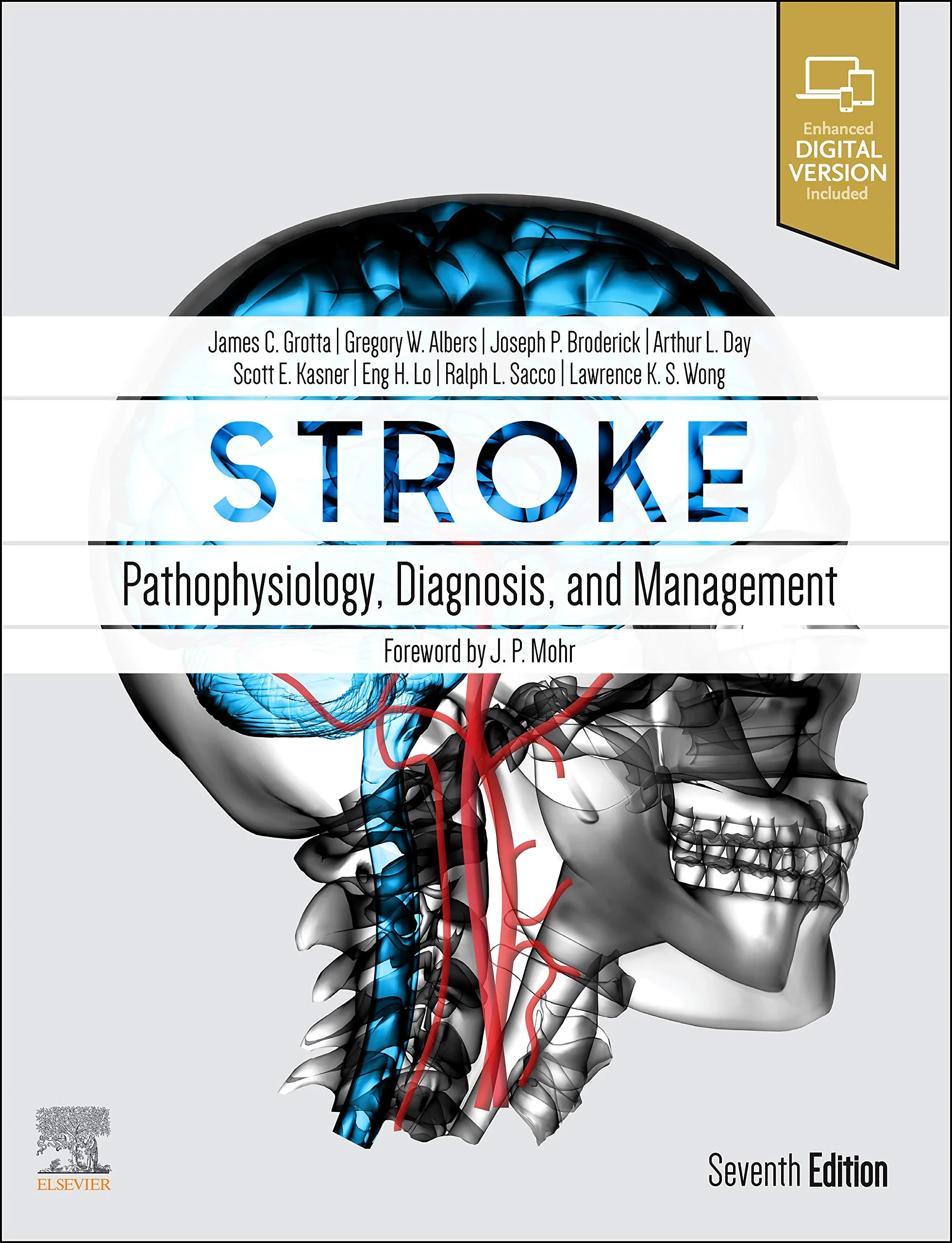 Coperta cărții "Stroke: Pathophysiology, Diagnosis, and Management" de James C. Grotta MD, Gregory W Albers MD, Joseph P Broderick MD