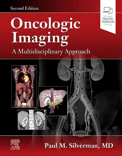 Coperta cărții "Oncologic Imaging: A Multidisciplinary Approach, 2nd Edition" de Silverman