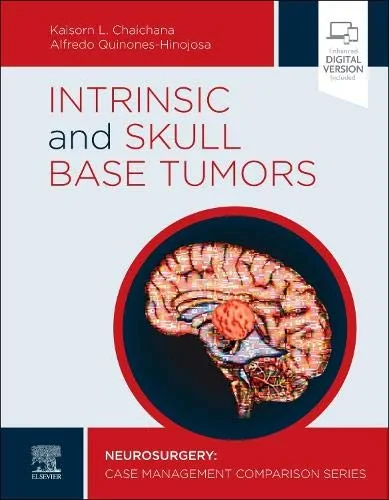 Coperta cărții "Intrinsic and Skull Base Tumors: Neurosurgery: Case Management Comparison Series" de Kaisorn Chaichana MD, Alfredo Quinones-Hinojosa MD FAANS FACS