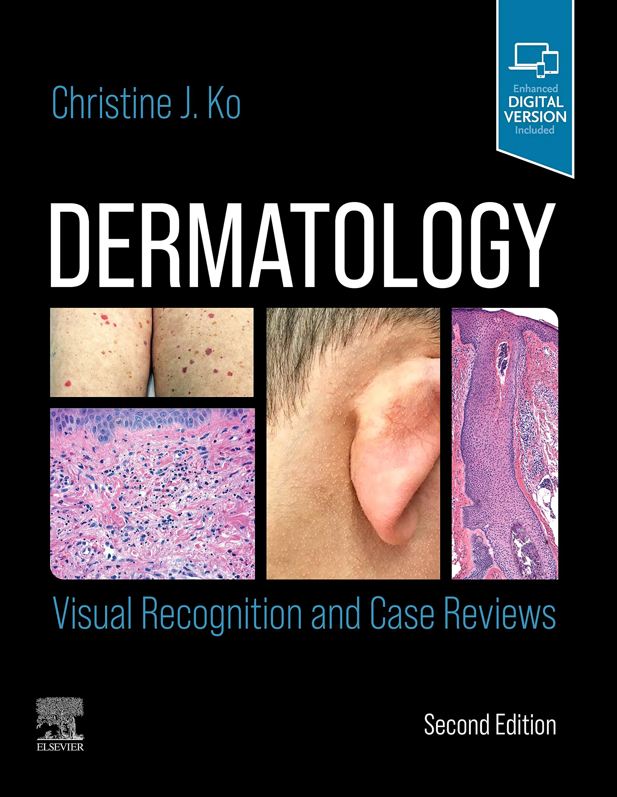 Coperta cărții "Dermatology: Visual Recognition and Case Reviews" de Christine J. Ko MD