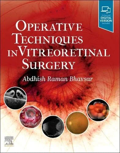 Coperta cărții "Operative Techniques in Vitreoretinal Surgery" de Abdhish Bhavsar