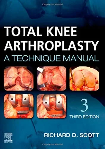 Coperta cărții "Total Knee Arthroplasty, 3rd Edition" de Richard D. Scott