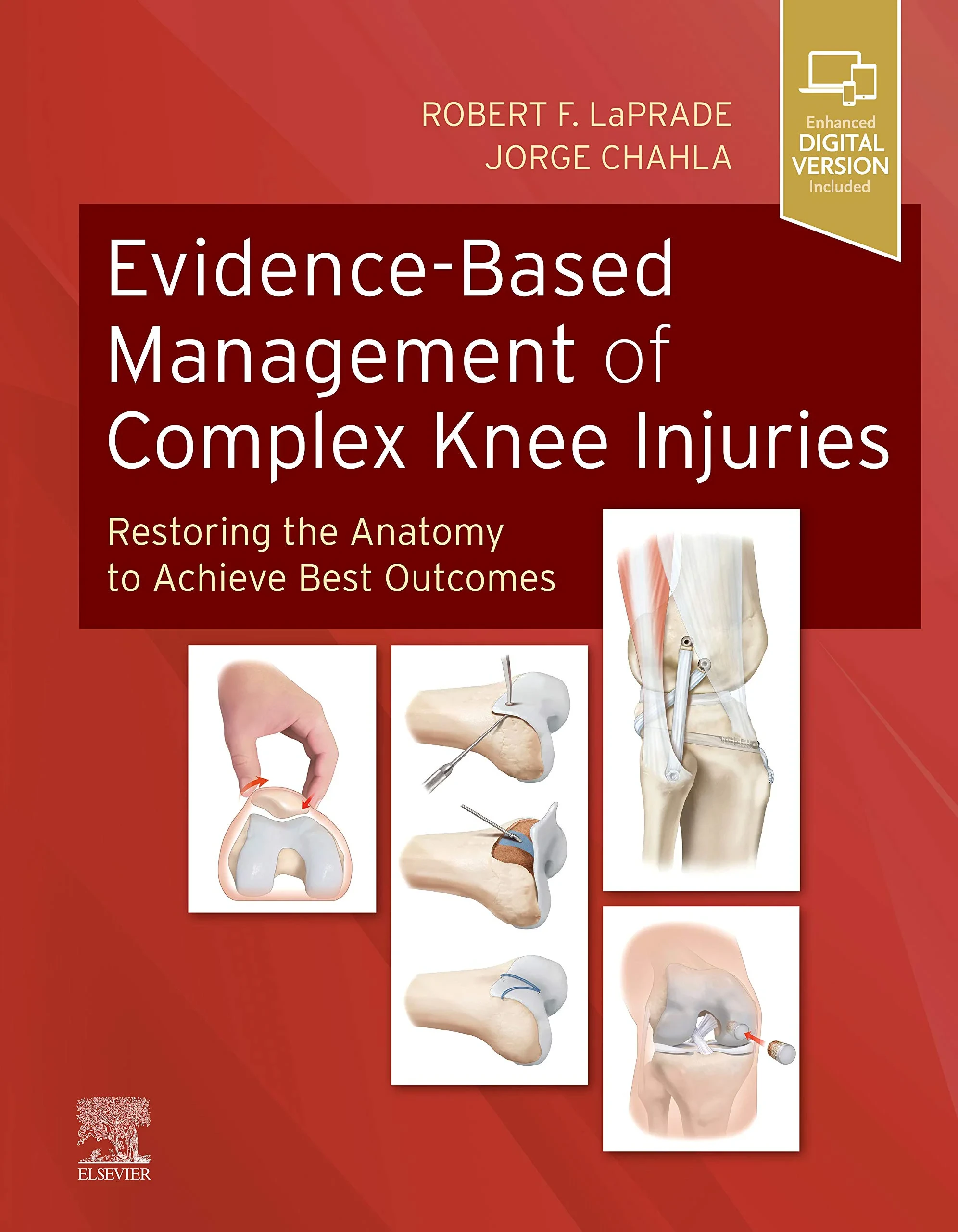 Coperta cărții "Evidence-Based Management of Complex Knee Injuries: Restoring the Anatomy to Achieve Best Outcomes" de Robert F. LaPrade MD PhD, Jorge Chahla MD PhD