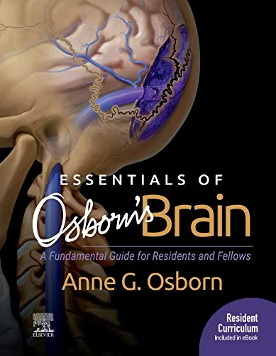 Coperta cărții "Essentials of Osborn’s Brain" de Anne G. Osborn