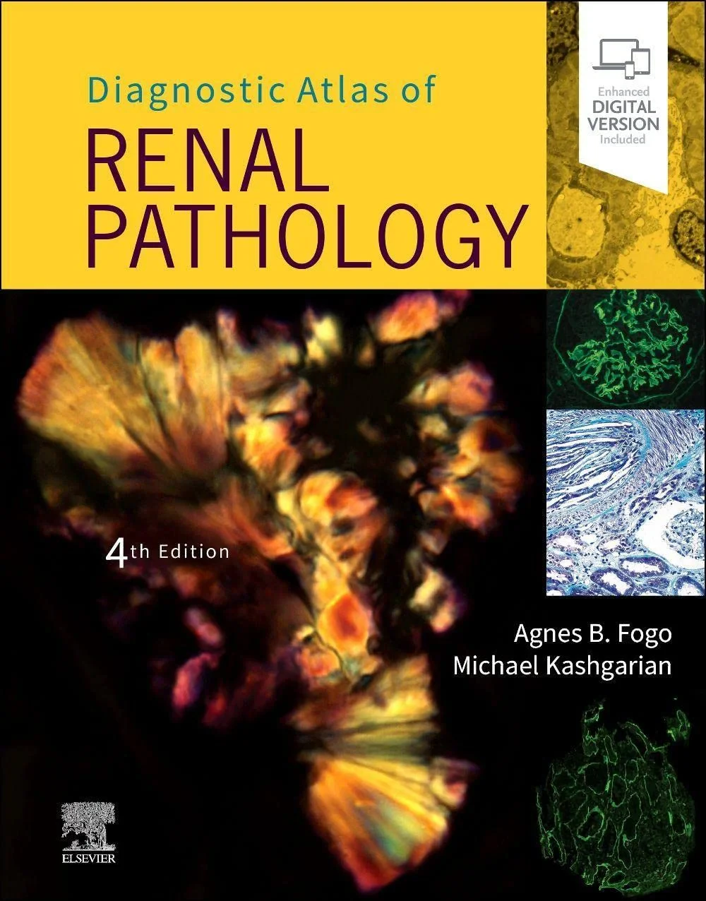 Coperta cărții "Diagnostic Atlas of Renal Pathology " de Agnes B. Fogo, Michael Kashgarian