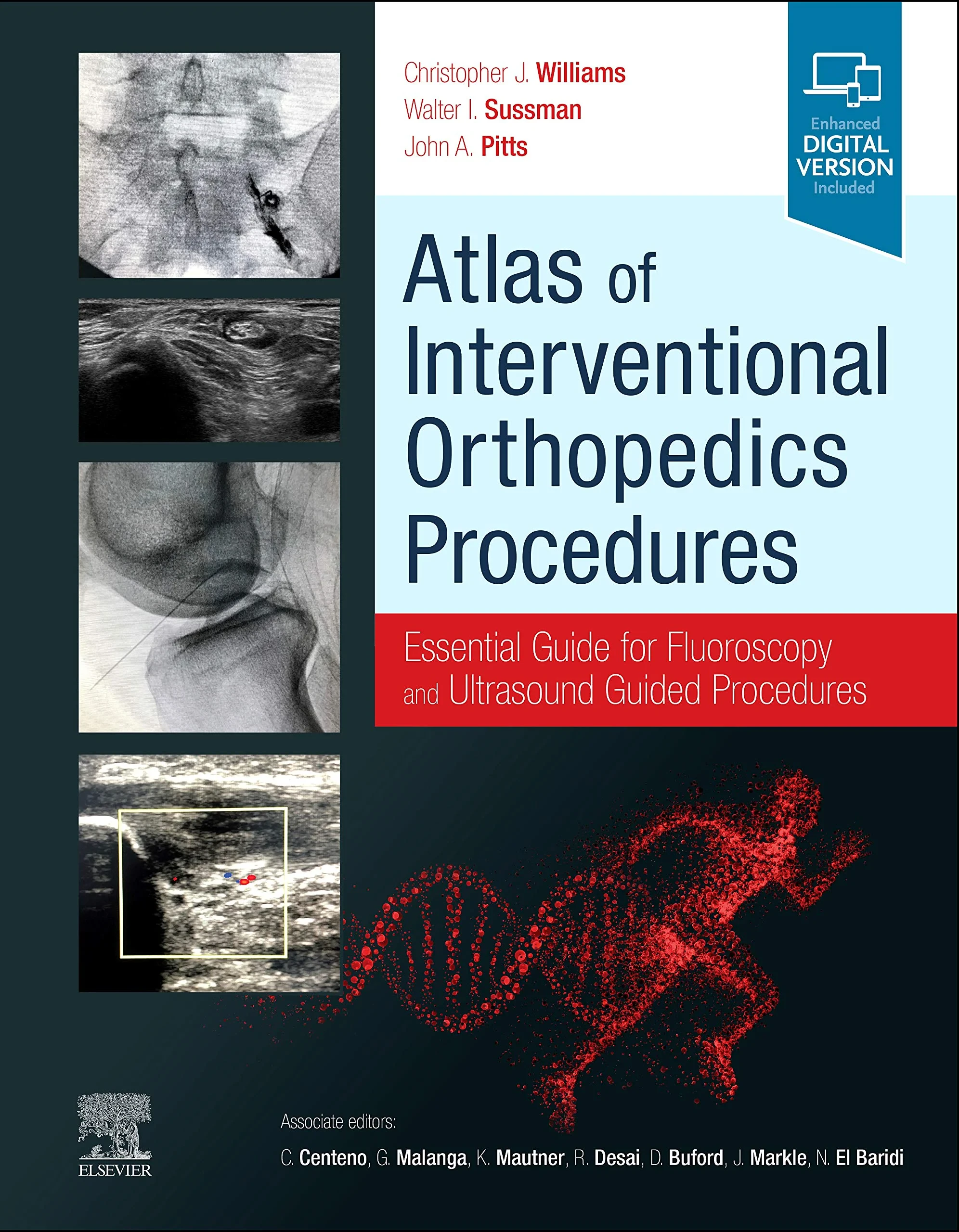 Coperta cărții "Atlas of Interventional Orthopedics Procedures: Essential Guide for Fluoroscopy and Ultrasound Guided Procedures" de Christopher J. Williams, Walter Sussman, John Pitts