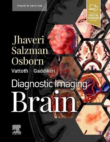 Coperta cărții "Diagnostic Imaging: Brain" de Miral D. Jhaveri MD