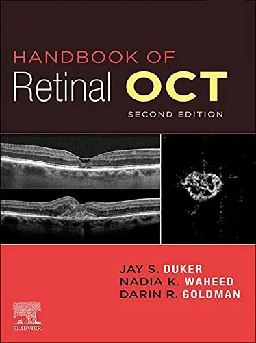 Coperta cărții "Handbook of Retinal OCT: Optical Coherence Tomography, 2nd Edition" de Duker, Waheed &amp; Goldman