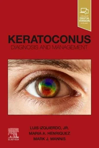 Coperta cărții "Keratoconus: Diagnosis and Management " de Luis Izquierdo, Maria Henriquez, Mark J. Mannis