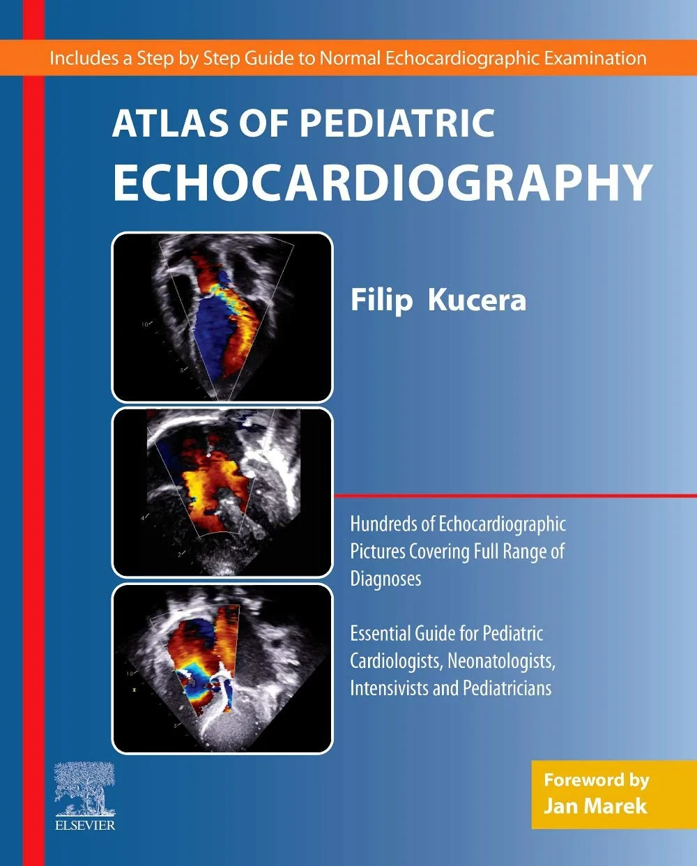 Coperta cărții "Atlas of Pediatric Echocardiography" de Filip Kucera