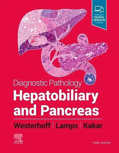 Coperta cărții "Diagnostic Pathology : Hepatobiliary and Pancreas " de Sanjay Kakar, Laura Webb Lamps, Maria Westerhoff