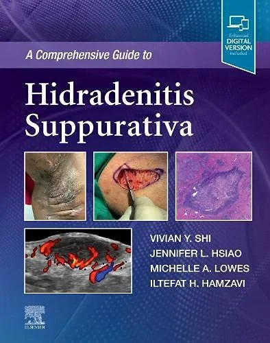 Coperta cărții "A Comprehensive Guide to Hidradenitis Suppurativa" de Vivian Y. Shi, Jennifer L. Hsiao, Michelle Lowes, Iltefat Hamzavi