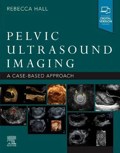 Coperta cărții "Pelvic Ultrasound Imaging: A Cased-Based Approach" de Rebecca Hall PhD RDMS FSDMS