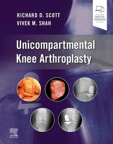 Coperta cărții "Unicompartmental Knee Arthroplasty" de Richard D. Scott, Vivek Shah