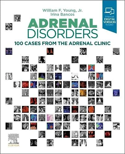 Coperta cărții "Adrenal Disorders: 100 Cases from the Adrenal Clinic " de William F. Young, Irina Bancos