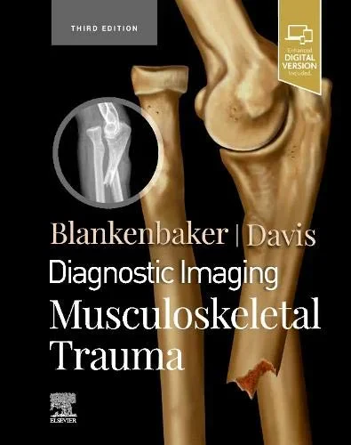Coperta cărții "Diagnostic Imaging: Musculoskeletal Trauma, 3rd Edition" de Donna G Blankenbaker MD FACR, Kirkland W. Davis MD FACR