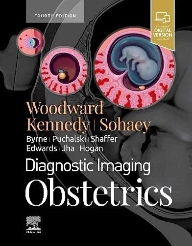 Coperta cărții "Diagnostic Imaging: Gynecology, 2e" de Paula J. Woodward MD