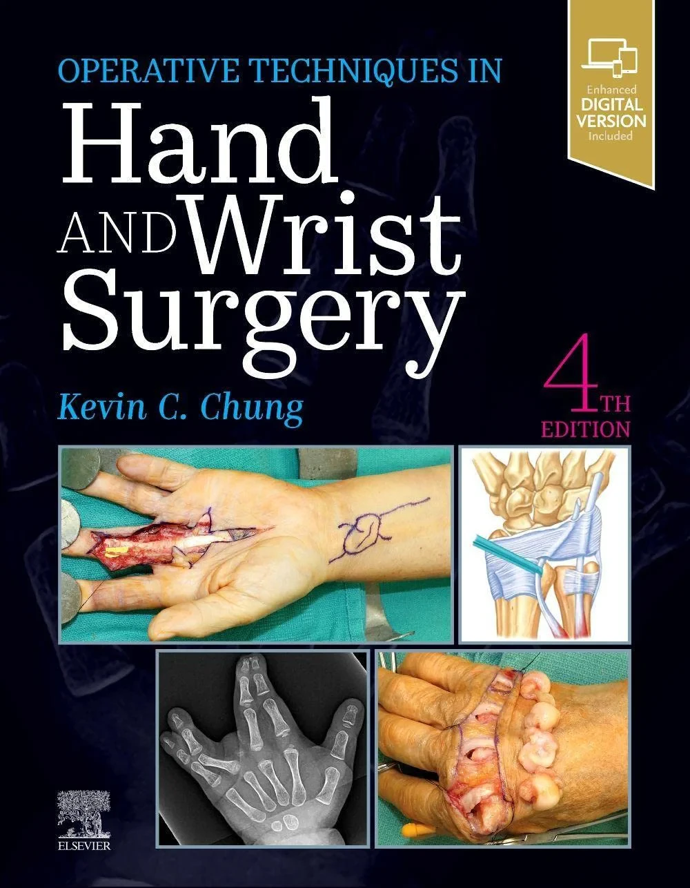 Coperta cărții "Operative Techniques: Hand and Wrist Surgery" de Kevin C. Chung