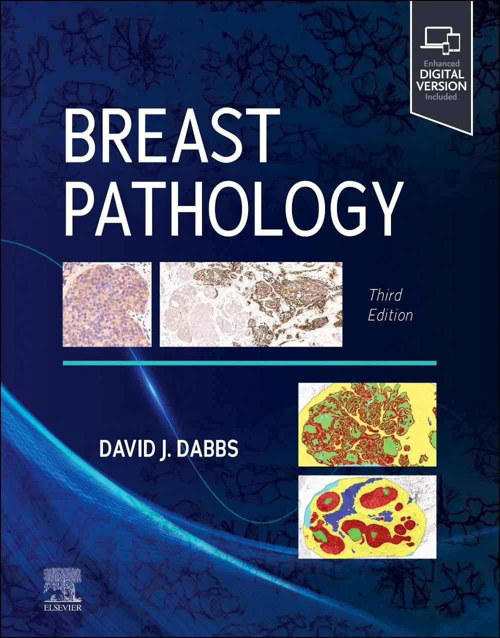 Coperta cărții "Breast Pathology" de David J Dabbs