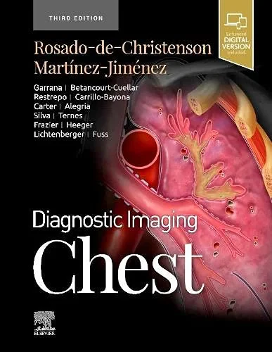 Coperta cărții "Diagnostic Imaging: Chest, 3rd Edition" de Melissa L. Rosado-de-Christenson MD FACR (Author), Santiago Martinez-Jimenez MD