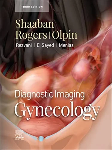 Coperta cărții "Diagnostic Imaging: Gynecology, 3rd Edition" de Shaaban &amp; Rogers