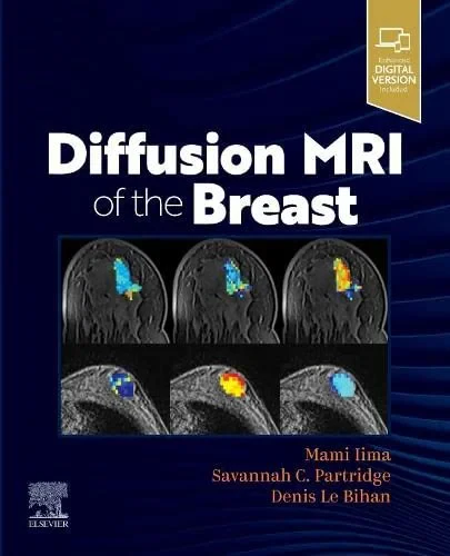 Coperta cărții "Diffusion MRI of the Breast" de WA, Department of Radiology, Professor, Mami Iima; Savannah Partridge, University of Washington, Seattle, USA and Denis Le Bihan, Mami Iima, Savannah Partridge