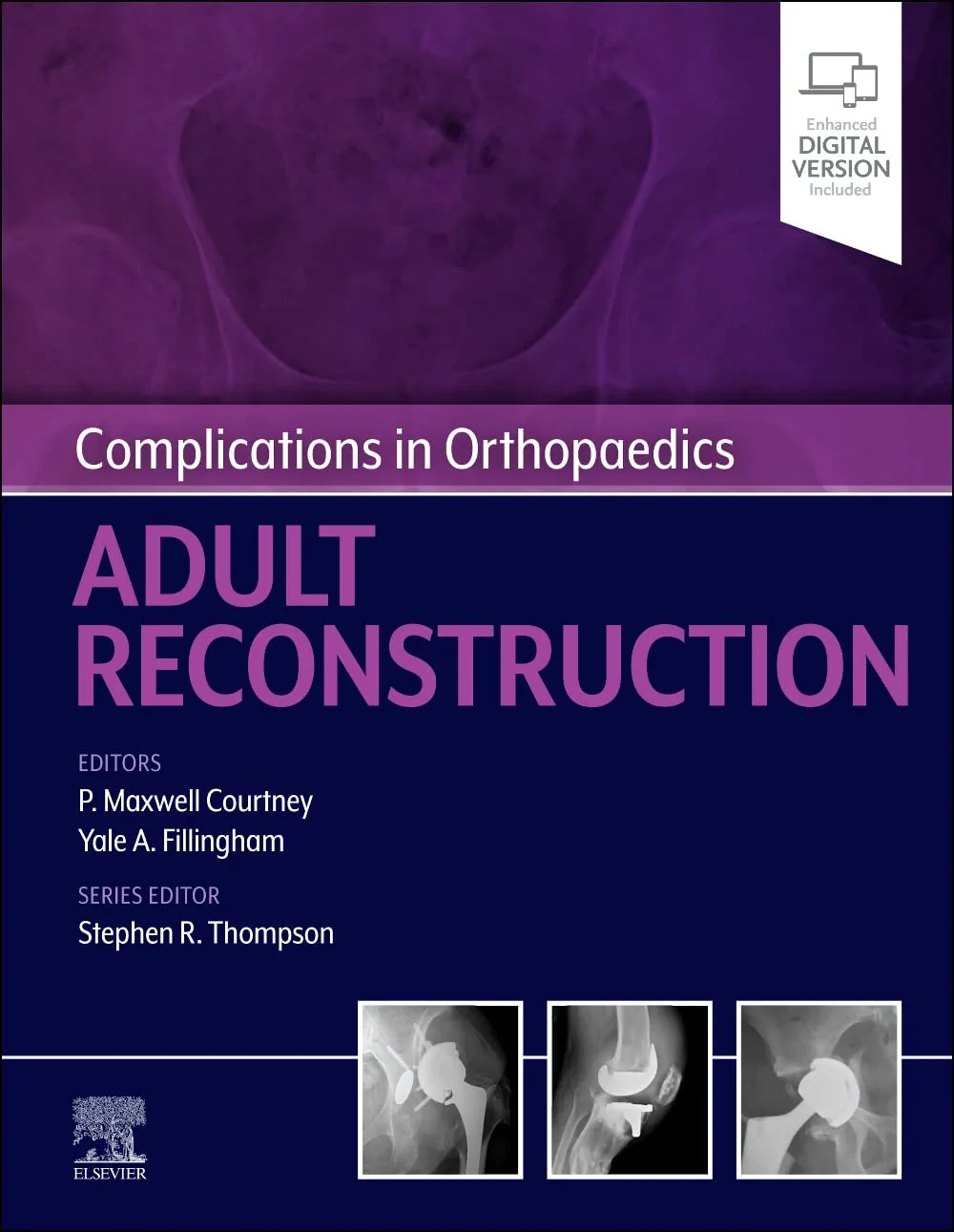 Coperta cărții "Complications in Orthopaedics: Adult Reconstruction" de Paul Maxwell Courtney, Yale A. Fillingham Stephen A. Thompson