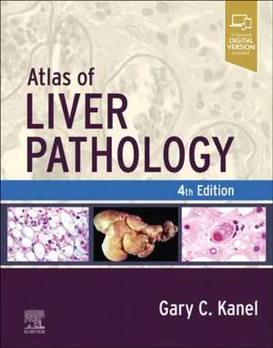 Coperta cărții "Atlas of Liver Pathology" de Gary C. Kanel