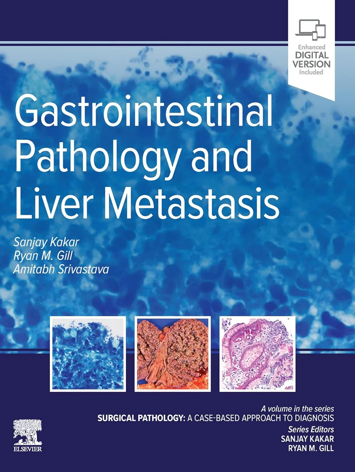 Coperta cărții "Gastrointestinal Pathology and Liver Metastasis: A Case-Based Approach to Diagnosis, 1st Edition " de Sanjay Kakar, Amitabh Srivastava, Ryan M. Gill