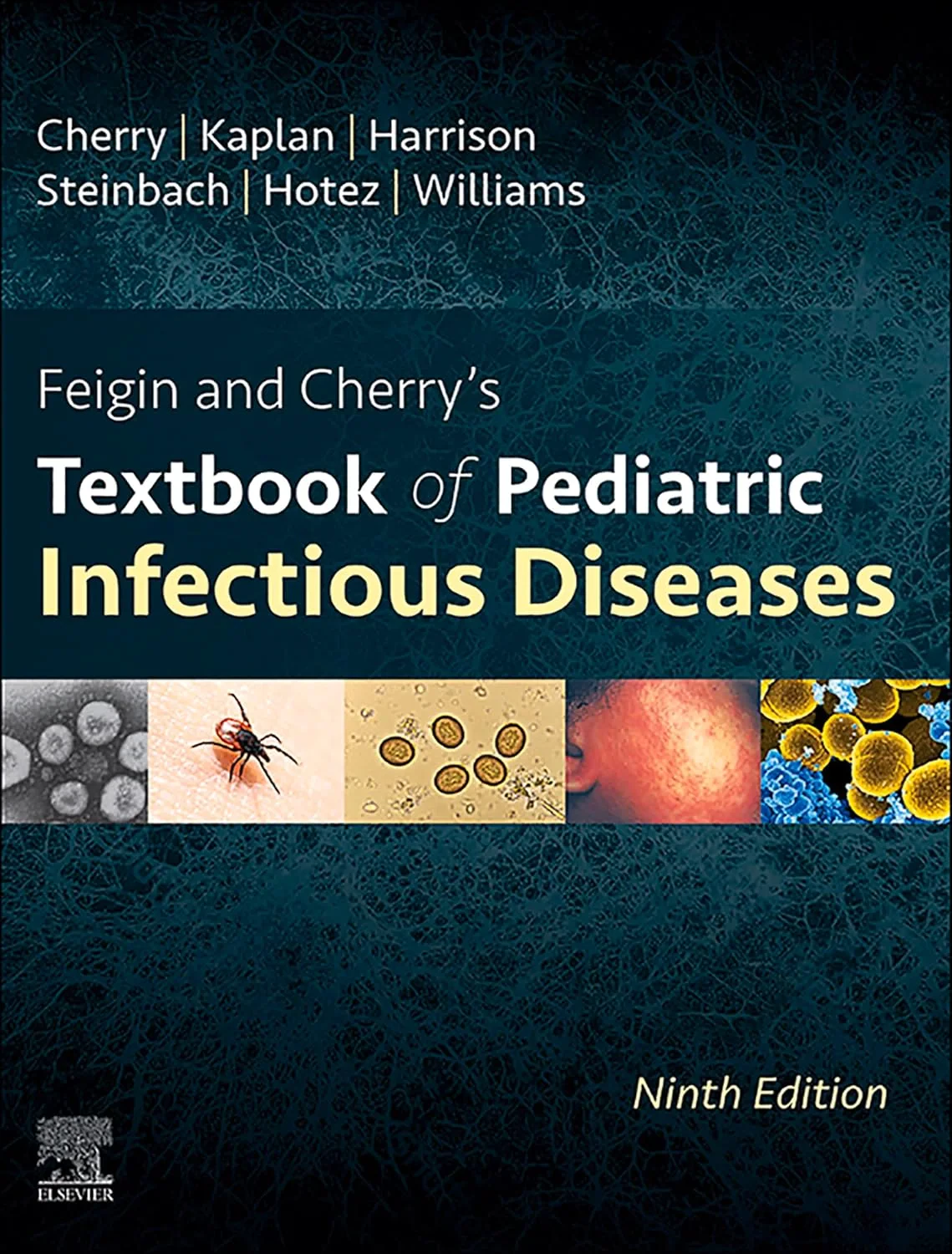 Coperta cărții "Feigin and Cherry’s Textbook of Pediatric Infectious Diseases: 2-Volume Set" de James Cherry, Gail J. Demmler-Harrison, Sheldon L. Kaplan, William Steinbach, Peter J Hotez, John V Williams