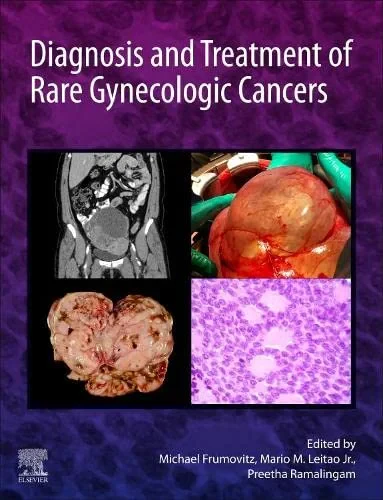 Coperta cărții "Diagnosis and Treatment of Rare Gynecologic Cancers" de Frumovitz, Leitao Jr. &amp; Ramalingam