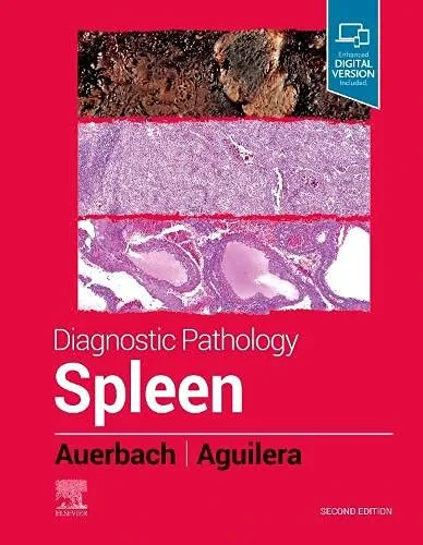 Coperta cărții "Diagnostic Pathology: Spleen, 2nd Edition" de Auerbach &amp; Aguilera