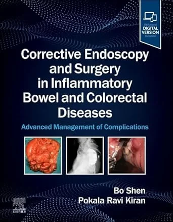 Coperta cărții "Corrective Endoscopy and Surgery in Inflammatory Bowel and Colorectal Diseases" de Bo Shen, Ravi P. Kiran