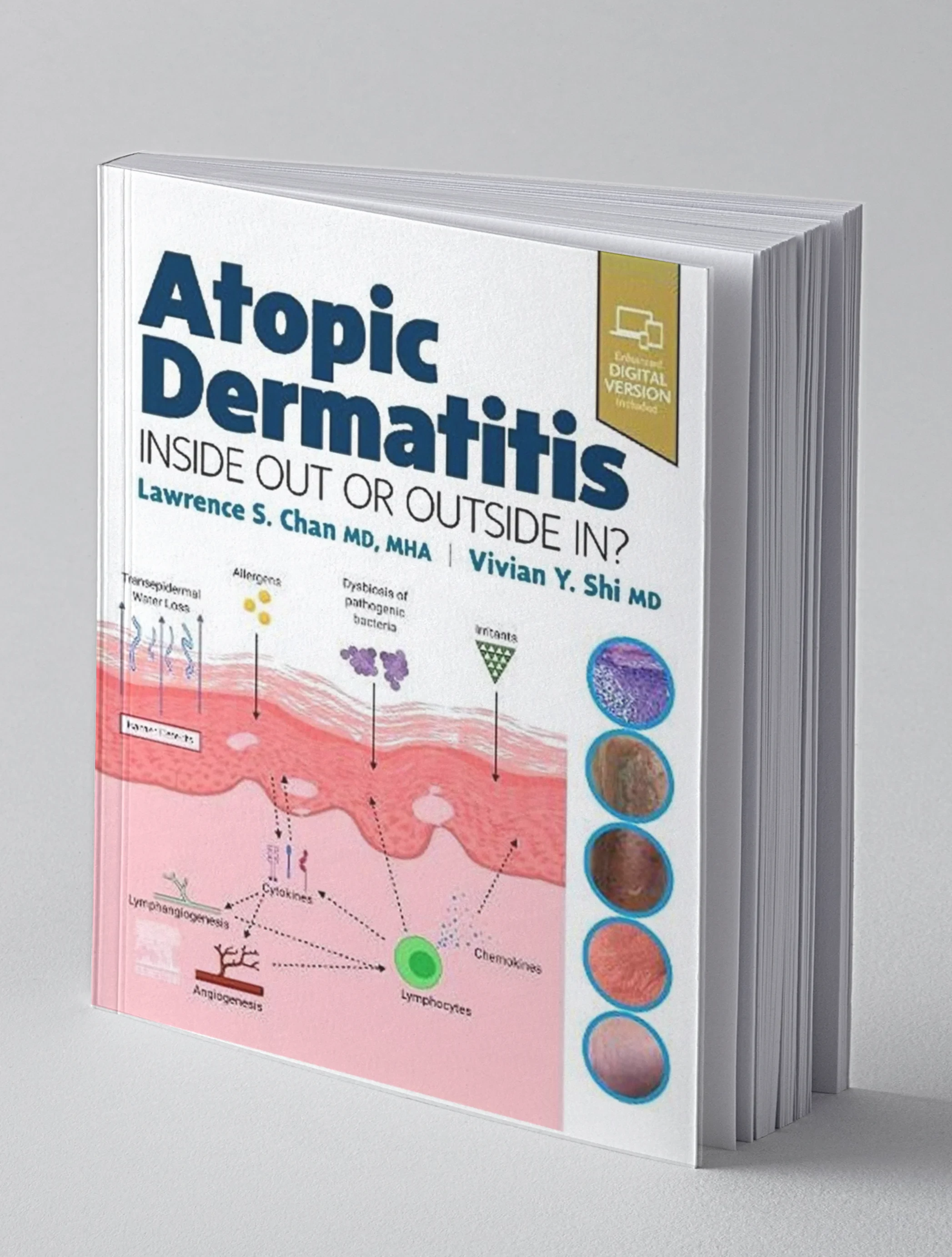 Coperta cărții "Atopic Dermatitis: Inside Out or Outside In" de Chan MD. MHA, Lawrence S, Shi MD, Vivian Y.