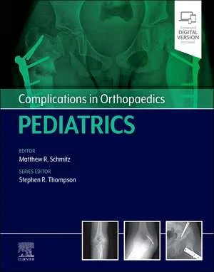 Coperta cărții "Complications in Orthopaedics: Pediatrics" de Matthew Schmitz, Stephen Thompson